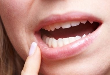 Як відбілити зуби?
