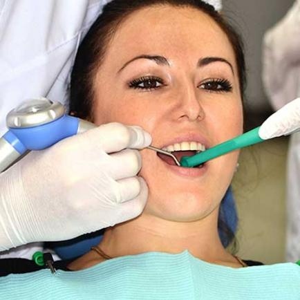 Як відбілити зуби?